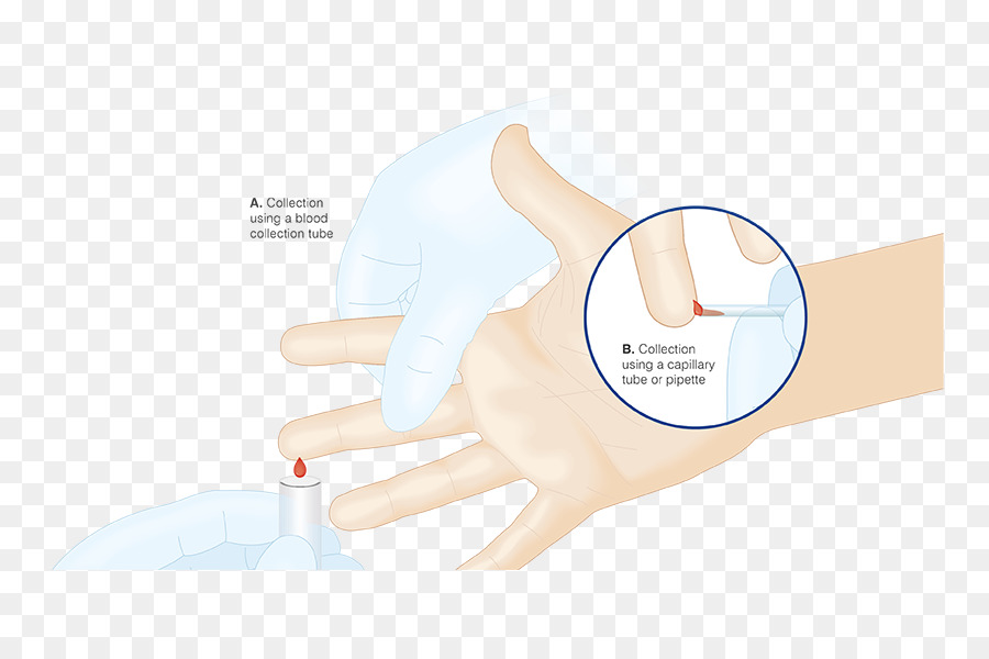 Daumen Medizinischen Handschuh Hand Modell - Blutprobe