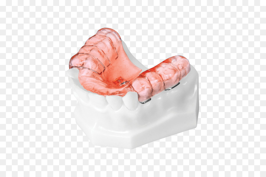 Dente Ortodonzia Casa apparecchio Ortodontico tecnologia di progettazione del Prodotto - correzione ortodontica