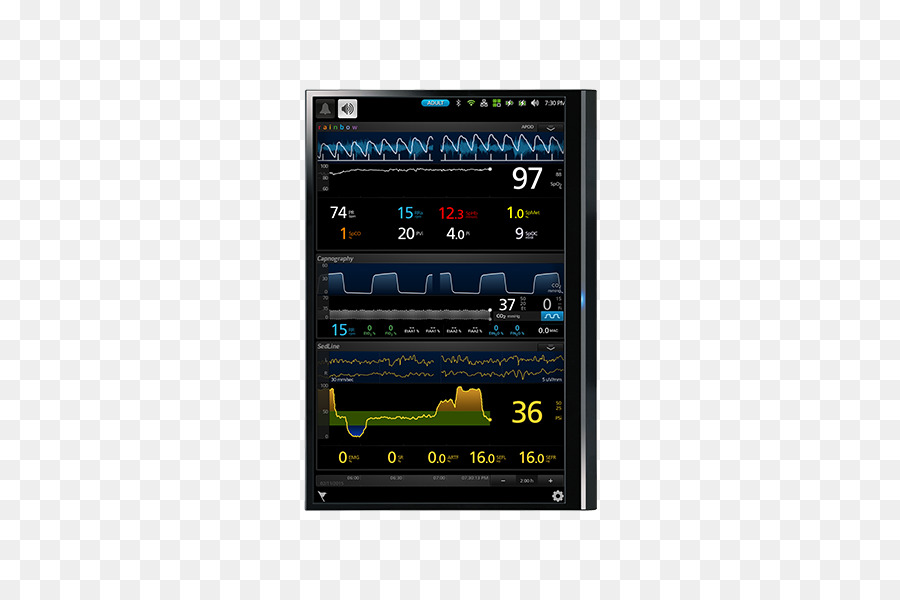 Dispositivo di visualizzazione Masimo unità di terapia Intensiva di Monitoraggio Perioperatorio - in sala operatoria