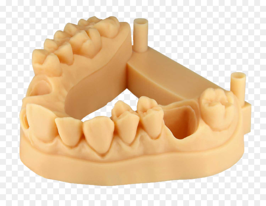 Zahn der 3D-Druck EnvisionTEC Krone additive Fertigung, 3D-Eindruck. - Krone