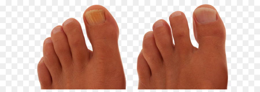 Nail Mano modello Pollice - unghia del piede