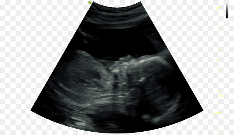 Ultrasound Black