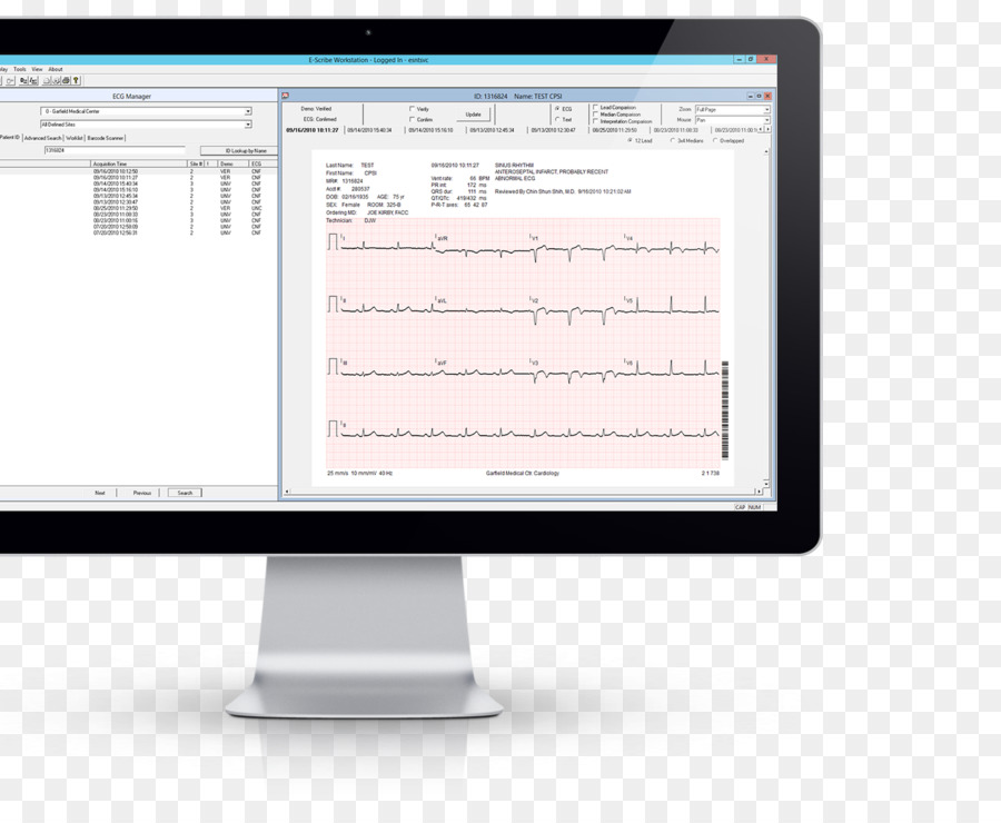 Informationen EKG, Welch Allyn CPR UI UB D PC Basierten Ruhe EKG Interpretierende Software ABPM 6100S Welch Allyn Cardioperfect 6100 Serie ABPM Management - Elektrokardiographie