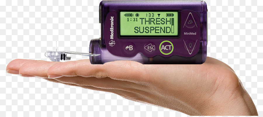 Pompa per l'insulina, il Diabete mellito Minimed Paradigm diabete di Tipo 1 - la somministrazione di insulina