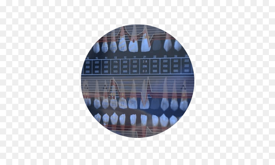 Simmetria blu Cobalto - disegno del sorriso dentale