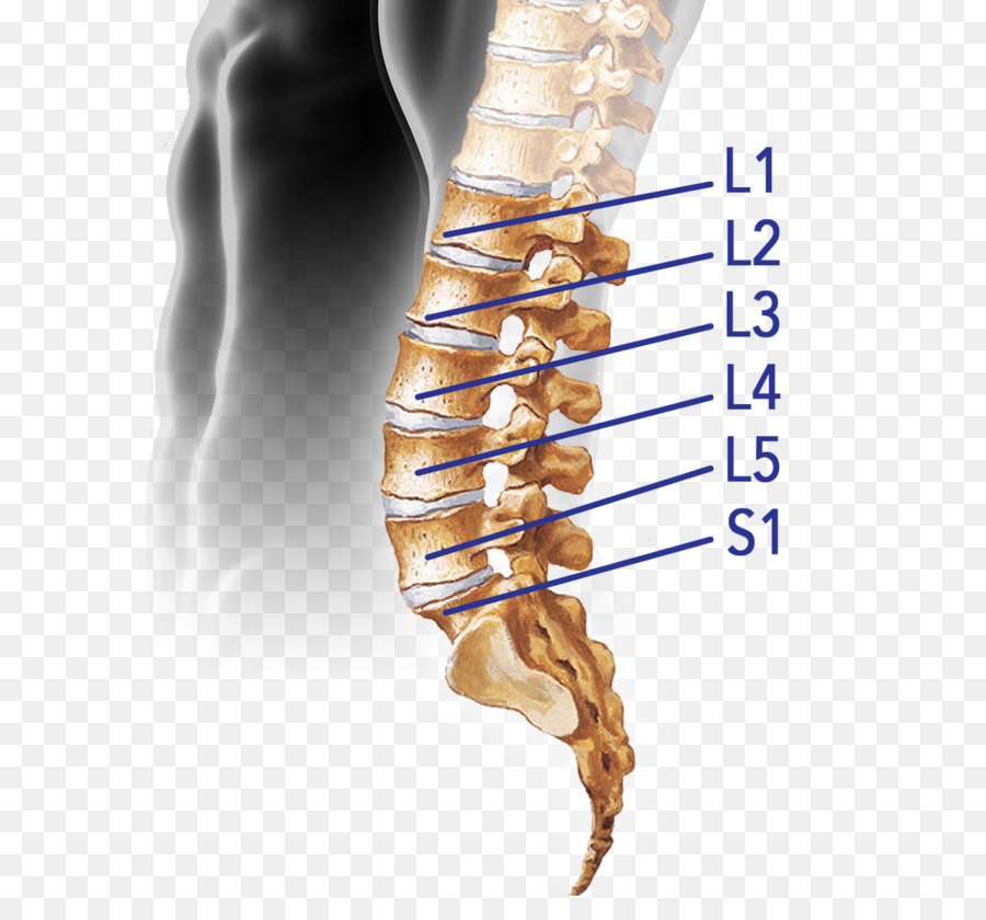 Wirbelsäule Bandscheibe Bandscheibenvorfall Bandscheibe Lendenwirbel Rückenmark - sacrum Knochen Schmerzen