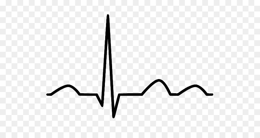 Elektrokardiographie clipart Kardiologie-Herz Sinusrhythmus - EKG
