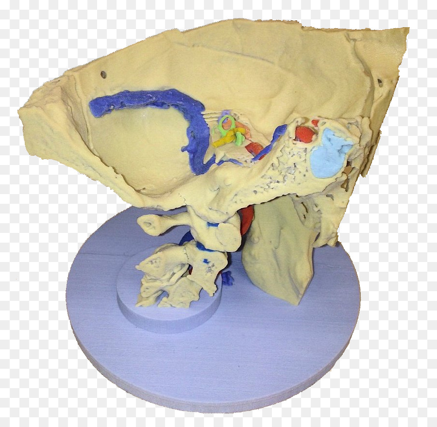 Temporal Knochen Anatomie Schädel Gesichtsnerv - Mittelohr-Mastoid