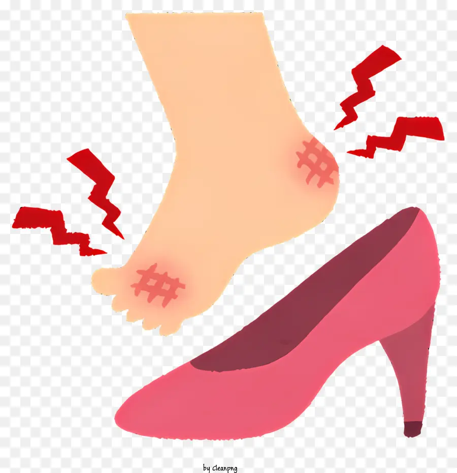 Health Blisterbehandlung Fußblasenmittel rot und geschwollene Blister Open Blister Care - Frau Fuß mit rotem, geschwollenem Blasen in High Heel