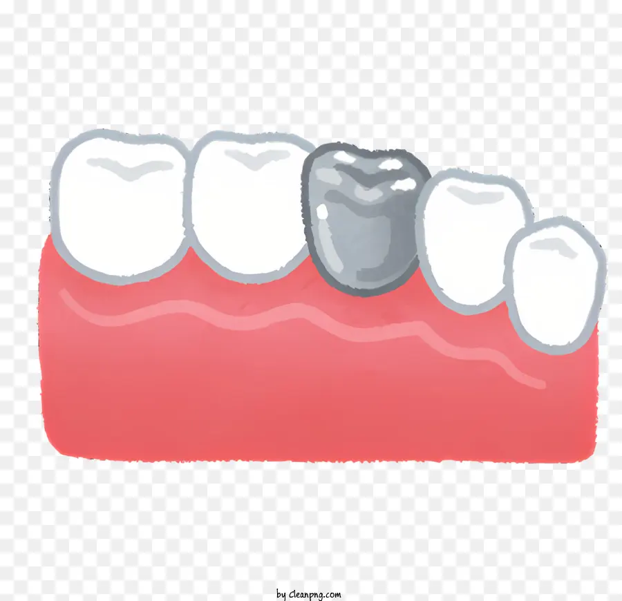 dente sano sano denti rosa denti bianchi simmetrici - Dente rosa sano senza decadimento